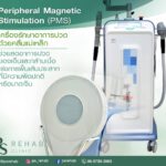เครื่อง PMS (Peripheral Magnetic Stimulation) เครื่องรักษาอาการปวดด้วยคลื่นแม่เห…