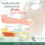 Golfer’s elbow หรือเรียกอีกอย่างหนึ่งว่า Medial epicondylitis เป็นอาการที่เกิดจ…