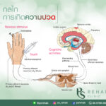 การเกิดความปวด ประกอบด้วย 3 สิ่ง
1. สิ่งกระตุ้นความปวด (Noxious Stimulus) 3 ปร…