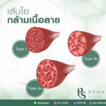 กล้ามเนื้อลาย (skeletal muscles)
เป็นกล้ามเนื้อทีเคลื่อนไหวตอบสนองความต้องการข…