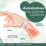 เดอโกแวง (De Quervain) หรือ เอ็นข้อมืออักเสบ
เป็นการอักเสบและเกิดการตีบแคบของเ…