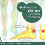 เอ็นร้อยหวายอักเสบ (ACHILLES TENDINITIS)
เอ็นร้อยหวายเป็นเส้นเอ็นที่ใหญ่สุดในร่…