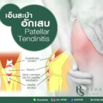 Patellar Tendinitis โรคเอ็นสะบ้าอักเสบ
มักพบได้ไม่บ่อยนักในคนทั่วไป
ส่วนมากพบ…