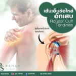 Rotator cuff tendinitis เอ็นข้อไหล่อักเสบ
เป็นภาวะที่เส้นเอ็นกล้ามเนื้อไหล่มีกา…