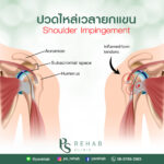 ภาวะกระดูกทับเส้นเอ็น
(shoulder impingement syndrome) (SIS)
จัดเป็นกลุ่มอากา…