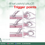 มาต่อเรื่อง Trigger Point กัน
วันนี้เราจะลองสังเกตุ ภายนอกของ Trigger point กัน…