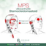 ปวดหัว หน้าผาก กกหู!! ปวดตา!! ปวดท้ายทอย!! เจ็บหน้าอก!!
อาจเป็นอาการของ MPS …