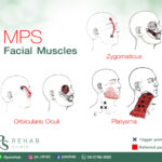 Facial Muscles ประกอบด้วยกล้ามเนื้อหลายมัด ได้แก่
– Orbicularis Oculi ทำหน้าที่…