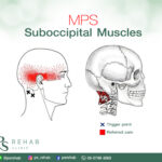 กล้ามเนื้อ Suboccipital
เป็นกล้ามเนื้อที่อยู่ใต้ศีรษะ ด้านหลัง ประกอบด้วยกล้ามเ…