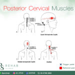 กล้ามเนื้อ Posterior Cervical
เป็นกลุ่มกล้ามเนื้อ 4 มัดเรียงต้วซ้อนทับกันอยู่บ…