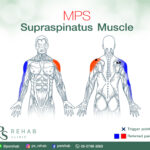 กล้ามเนื้อ Supraspinatus เป็นกล้ามเนื้อที่เกาะอยู่บริเวณหัวไหล่และส่วนบนของสะบั…