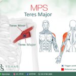 กล้ามเนื้อ Teres Major
เป็นกล้ามเนื้อที่มีจุดเกาะอยู่บริเวณ ด้านหลังส่วนล่างขอ…