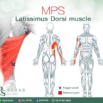 กล้ามเนื้อ Latissimus Dorsi เป็นกล้ามเนื้อบริเวณหลังส่วนล่าง คลอบคลุมบริเวณเอว แ…