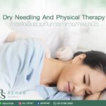 Part Trigger point: ามเนื้อ Trigger point
ด้วย การฝังเข็ม Dry Needling และ การ…