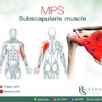 กล้ามเนื้อ Subscapularis
เป็นกล้ามเนื้อสามเหลี่ยมขนาดใหญ่อยู่ด้านหน้าของกระดูก…