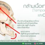 กล้ามเนื้อ Temporalis
กล้ามเนื้อมัดสำคัญที่ช่วยในการเคี้ยวอาหาร และการพูดคุย
…