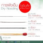 เข็มที่คุณหมอใช้ ขนาดเท่าไหนกันนะ?
หลายๆท่านดูคลิปคุณหมอไปแล้ว
หรือมาให้คุณห…