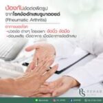 โรคข้ออักเสบรูมาตอยด์ (Rheumatoid arthritis)
เป็นโรคของข้อต่อที่เกิดจากการอักเ…