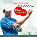 อาการเจ็บข้อศอกของนักกอล์ฟ
มักพบบริเวณเอ็นกล้ามเนื้อที่เกาะที่ปุ่มกระดูกข้อศอก…