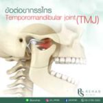 ข้อต่อขากรรไกร (Temporomandibular joint)
เป็นข้อต่อระหว่างฐานกระโหลกศีรษะและขาก…