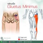 กล้ามเนื้อ Gluteus minimus
เป็นกล้ามเนื้อที่เล็กที่สุดในกลุ่ม Gleteus และอยู่ล…